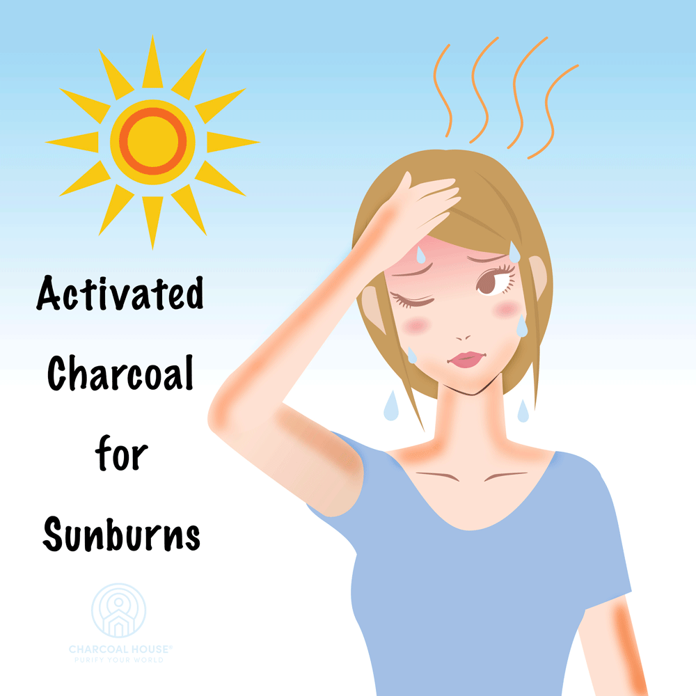 Activated Charcoal for Sunburns