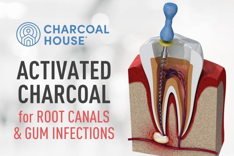 Activated Charcoal for Root Canal, Jaw Infection